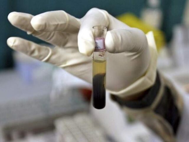 Hepatitis en menores de Europa PAUSA.MX