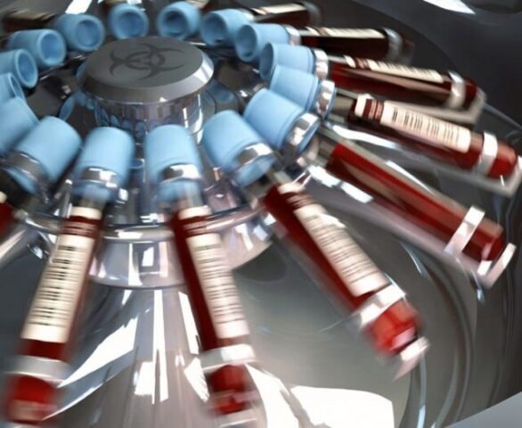 Pausa.mx Sangres Cultivada en Laboratorio, Transfusión de Sanfre