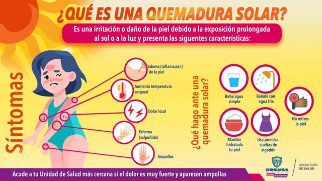 Noticias Chihuahua PAUSA.MX Emite Secretaría de Salud recomendaciones ante padecimientos en temporada de calor