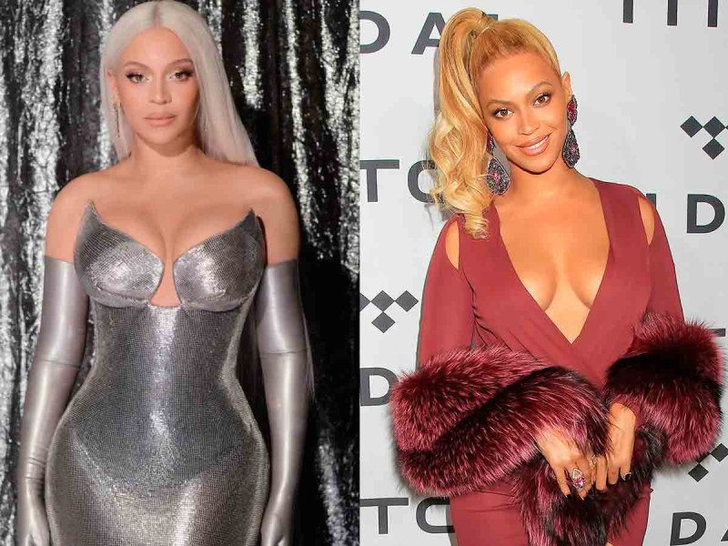 blanqueamiento de la piel antes y después de beyonce