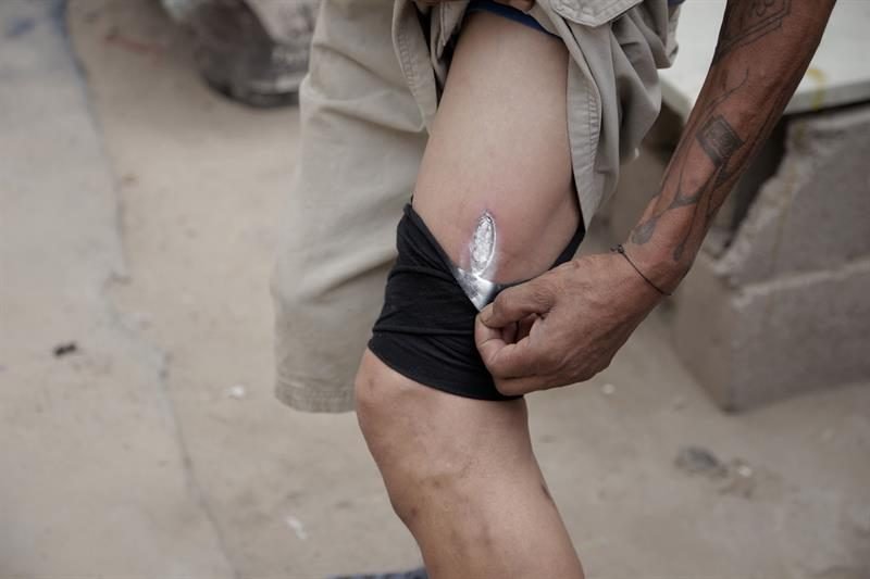 14528069w-1-1132x670