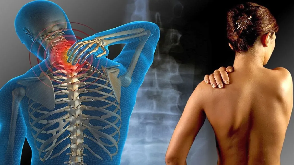 Conoce los beneficios que da la rehabilitación física a pacientes con fibromialgia