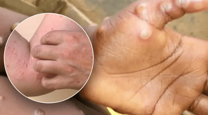 imagen_2024-07-12_164438185