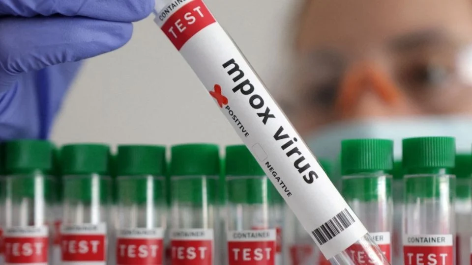 OMS autoriza el uso de emergencia de prueba de diagnóstico de mpox
