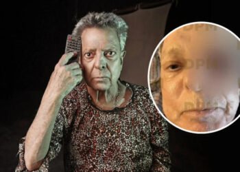 Hijo de César Bono desmiente que el actor haya perdido un ojo tras detectar un tumor Hijo de César Bono desmiente que el actor haya perdido un ojo tras detectar un tumor