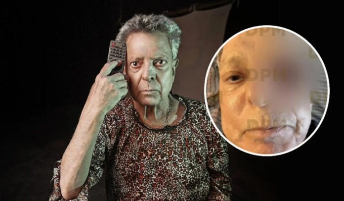 Hijo de César Bono desmiente que el actor haya perdido un ojo tras detectar un tumor