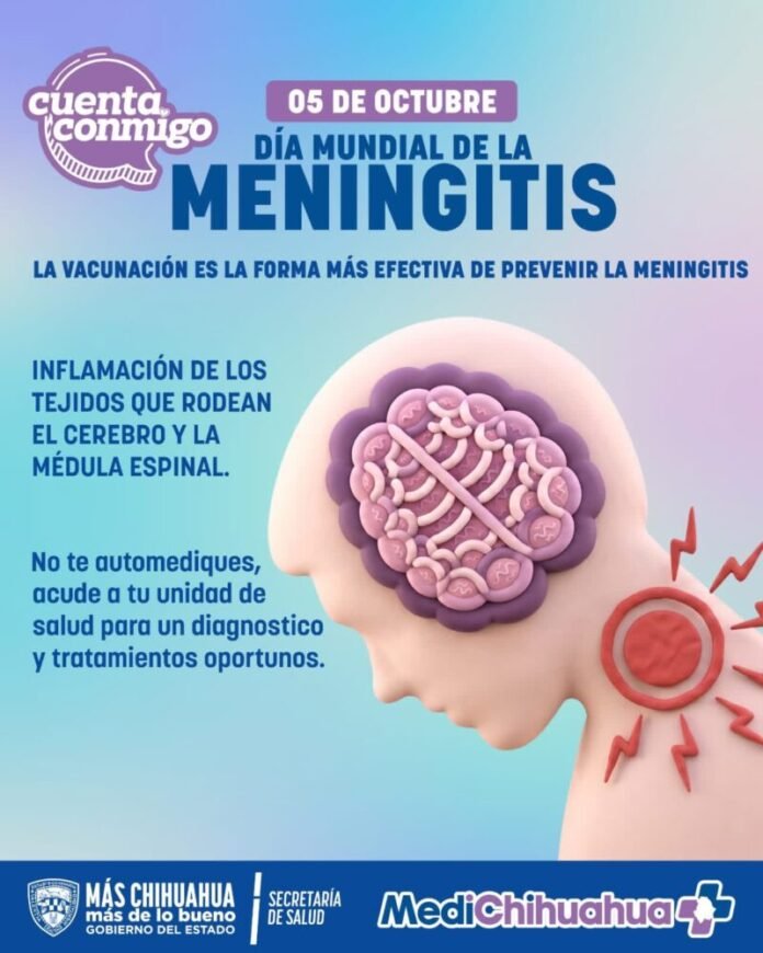 Chihuahua registra 50 casos de síndrome meníngeo en 2026